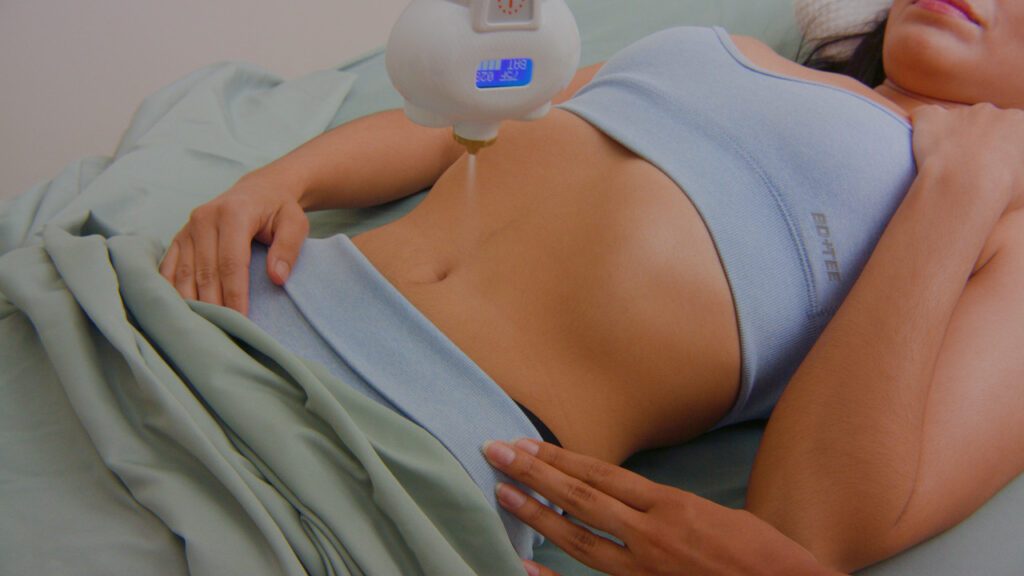 Cryo slimming before and after results in Renton, WA — Cryo Sanctuary
