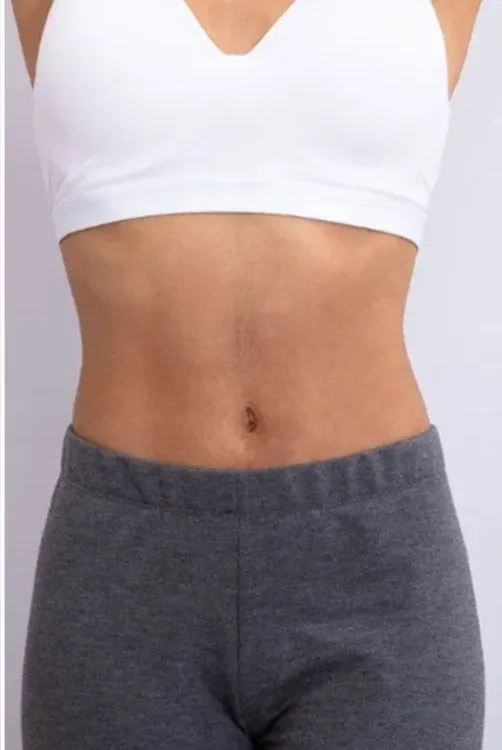 Cryo slimming before and after results in Renton, WA — Cryo Sanctuary